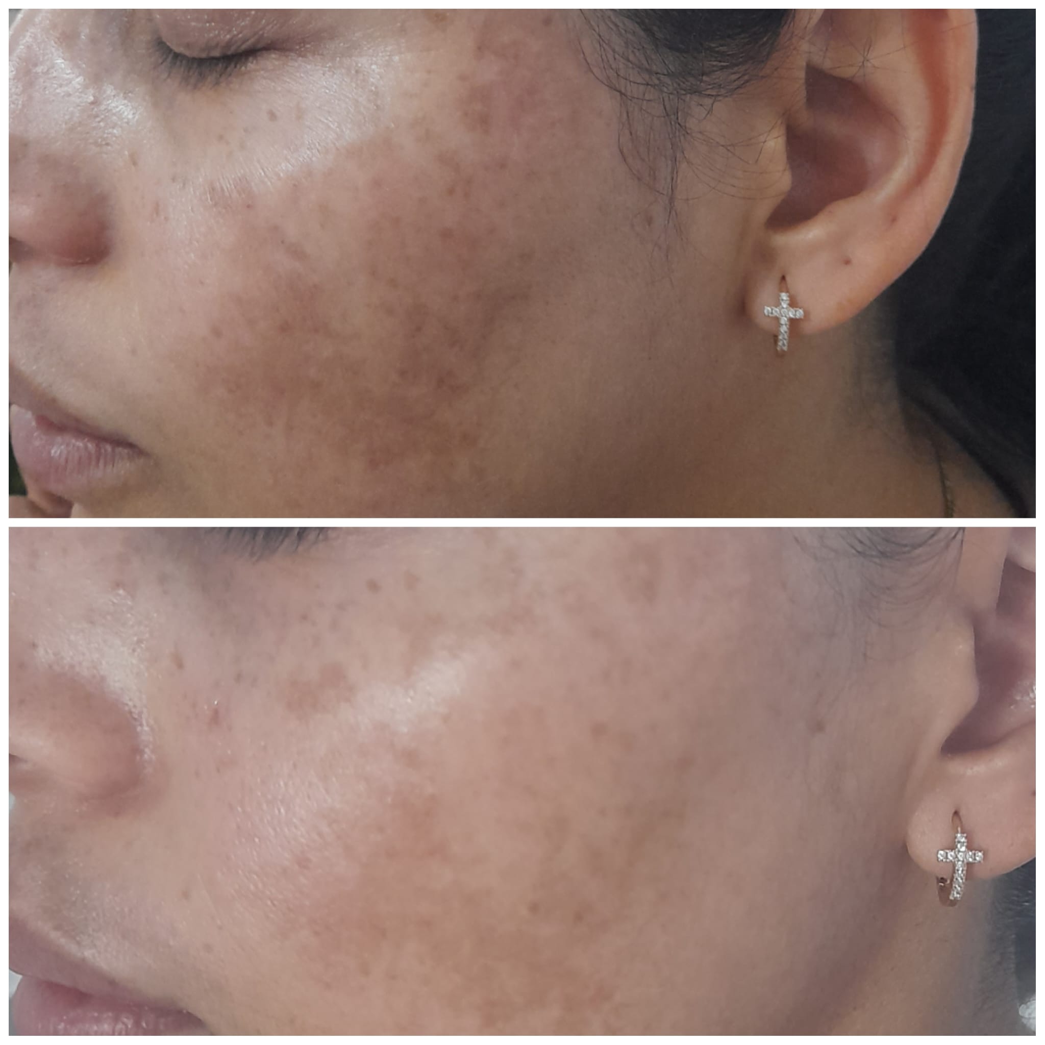 Estética Facial